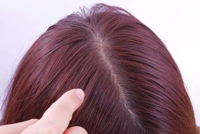 頭皮が乾燥する原因は？健康的な髪を目指すためのおすすめ乾燥対策！